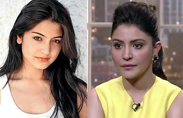 Lip-Job-Anushka-Sharma