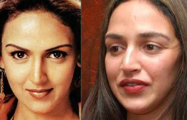 Lip-Job-Esha-Deol