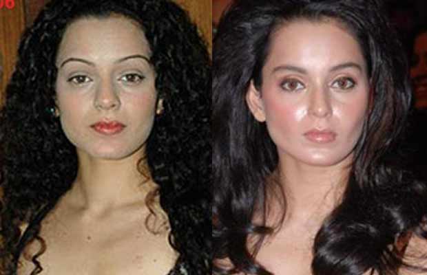 Lip-Job-Kangana-Ranaut