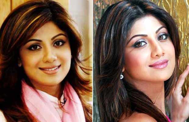 Lip-Job-Shilpa-Shetty