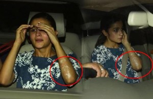 Alia Bhatt Suffers From Major Burns During Her Performance