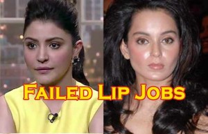 Bollywood Lip-Jobs That Were Disasters!