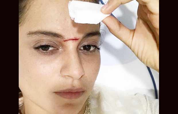 Kangana Ranaut On Her Injury: I Am Excited That My Face Was Covered In Blood