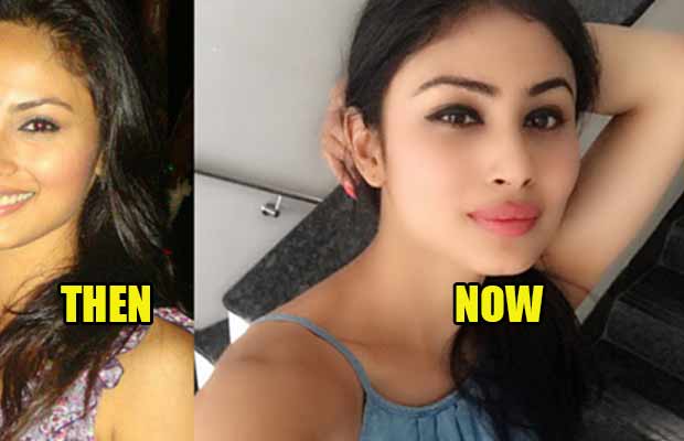 Here’s The List Of 10 TV Actresses Who Went Under Plastic Surgery!