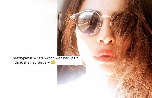 Oops! After Nose Job, Priyanka Chopra Gets TROLLED For Getting Lip Job